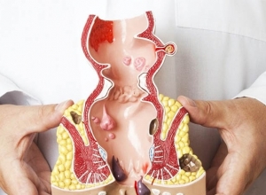Các bài tập làm co búi trĩ hiệu quả nên áp dụng ngay